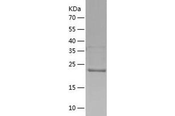 HIV-1 Tat Interactive Protein 2, 30kDa (HTATIP2) (AA 1-242) protein (His tag)