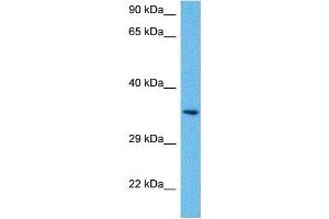 Host:  Mouse  Target Name:  PITX1  Sample Tissue:  Mouse Brain  Antibody Dilution:  1ug/ml (PITX1 Antikörper  (N-Term))