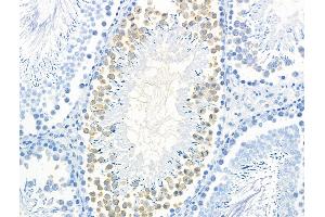 Phospho-Calsenilin/KCNIP3 (Ser63) Antibody at 1/100 staining Rat testis tissue by IHC-P.