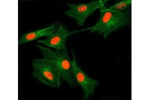 IF analysis of SNRNP27 and Tubulin beta using anti-SNRNP27 antibody (ABIN7599614) and anti-Tubulin beta antibody (ABIN7602744). (SNRNP27 Antikörper  (AA 100-155))