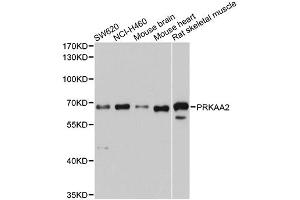 Western blot analysis of extracts of various cell lines, using PRKAA2 antibody (ABIN4904853) at 1:1000 dilution. (PRKAA2 Antikörper)