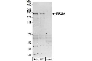 Western Blotting (WB) image for anti-Kinesin Family Member 21A (KIF21A) (AA 1-50) antibody (ABIN7453115)