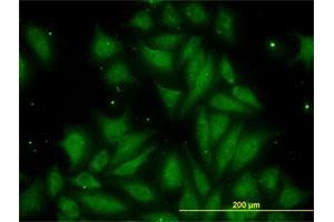 Immunofluorescence of monoclonal antibody to TIMP2 on HeLa cell. (TIMP2 Antikörper  (AA 27-220))