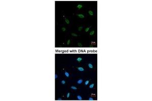 ICC/IF Image Immunofluorescence analysis of paraformaldehyde-fixed HeLa, using MCM7, antibody at 1:200 dilution. (MCM7 Antikörper)