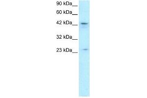 Human HepG2; WB Suggested Anti-ZNF365 Antibody Titration: 0. (ZNF365 Antikörper  (N-Term))