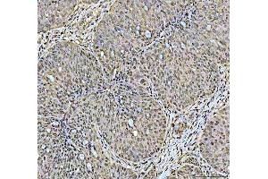 IHC analysis of DCK using anti-DCK antibody (ABIN5693016). (DCK Antikörper  (AA 17-260))