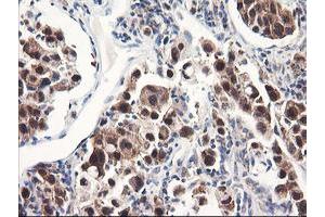 Image no. 8 for anti-F-Box Protein 21 (FBXO21) antibody (ABIN1498232) (FBXO21 Antikörper)