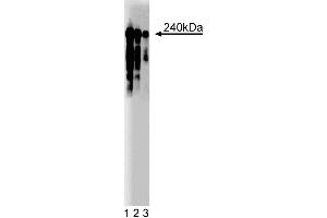 Western blot analysis of CRIK on Rat PC12 cell lysate (ATCC CRL-1721). (CIT Antikörper  (AA 1420-1612))