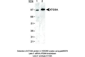 Image no. 1 for anti-ATG9 Autophagy Related 9 Homolog A (S. Cerevisiae) (ATG9A) (AA 750-839), (C-Term) antibody (ABIN363584) (ATG9A Antikörper  (C-Term))