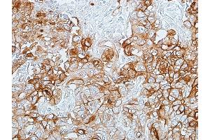 Immunohistochemistry (IHC) image for anti-Carcinoembryonic Antigen-Related Cell Adhesion Molecule 1 (CEACAM1) (AA 35-433) antibody (ABIN7455148) (Rekombinanter CEACAM1 Antikörper  (AA 35-433))