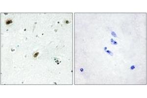 Immunohistochemistry (IHC) image for anti-C-Abl Oncogene 1, Non-Receptor tyrosine Kinase (ABL1) (AA 861-910) antibody (ABIN2889373) (ABL1 Antikörper  (AA 861-910))