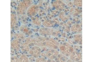 Used in DAB staining on fromalin fixed paraffin- embedded kidney tissue (PTPN21 Antikörper  (AA 983-1176))