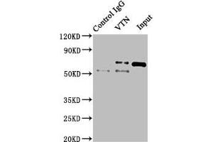 Vitronectin Antikörper  (AA 364-478)