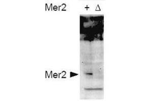 Western blot using  affinity purified anti-S. (CD151 Antikörper  (pSer30))