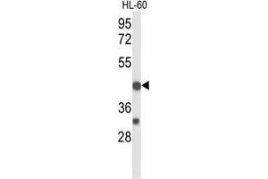 Western Blotting (WB) image for anti-Tumor Necrosis Factor Receptor Superfamily, Member 10d, Decoy with Truncated Death Domain (TNFRSF10D) (AA 258-287), (Middle Region) antibody (ABIN951252)