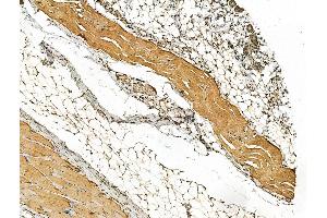 ABIN6262768 and ABIN6266577 at 1/100 staining Rat skin tissue by IHC-P. (Keratin 10 Antikörper  (Internal Region))