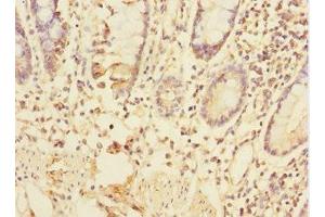 Immunohistochemistry of paraffin-embedded human small intestine tissue using ABIN7172318 at dilution of 1:100 (TRIAP1 Antikörper  (AA 1-76))