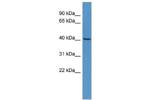 WB Suggested Anti-RASSF6 Antibody Titration: 0.