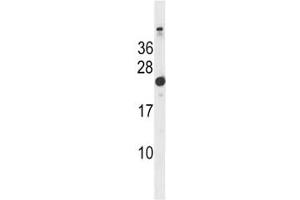 Hras1 antibody western blot analysis in mouse bladder tissue lysate. (HRAS Antikörper  (AA 151-179))