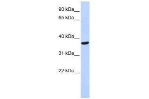 SPDYA antibody used at 1 ug/ml to detect target protein. (SPDYA Antikörper)