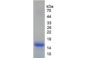 SDS-PAGE analysis of Human Lymphocyte Antigen 96 Protein. (LY96 Protein)
