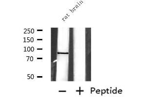 Western blot analysis of extracts from rat brain, using EXT1 Antibody. (EXT1 Antikörper)