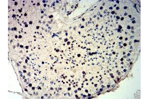 Immunohistochemical analysis of paraffin-embedded testis tissues using CDKN1C mouse mAb with DAB staining. (CDKN1C Antikörper)