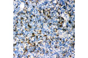 IHC(P): Human Tonsil Tissue (CD8 alpha Antikörper  (AA 22-187))
