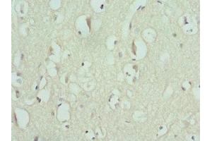 Immunohistochemistry of paraffin-embedded human brain tissue using ABIN7151371 at dilution of 1:100 (ENTPD2 Antikörper  (AA 28-268))
