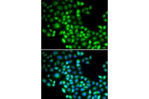 Immunofluorescence analysis of U20S cell using FOXP1 antibody. (FOXP1 Antikörper)