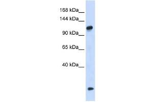 HEATR4 antibody used at 1 ug/ml to detect target protein. (HEATR4 Antikörper  (N-Term))