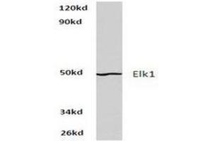 Image no. 1 for anti-ELK1, Member of ETS Oncogene Family (ELK1) antibody (ABIN265398) (ELK1 Antikörper)
