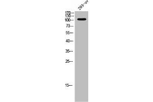 Western Blot analysis of 293T-UV cells using EphA3 Polyclonal Antibody (EPH Receptor A3 Antikörper  (C-Term))