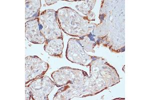 Immunohistochemistry of paraffin-embedded human placenta using PDGFRB antibody (ABIN3023138, ABIN3023139, ABIN3023140 and ABIN6219408) at dilution of 1:100 (40x lens). (PDGFRB Antikörper  (AA 887-1106))
