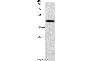 Western blot analysis of Mouse brain tissue, using B3GAT1 Polyclonal Antibody at dilution of 1:400