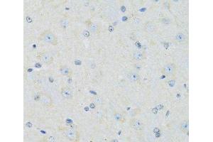 Immunohistochemistry of paraffin-embedded Mouse brain using SLC22A5 Polyclonal Antibody at dilution of 1:100 (40x lens). (SLC22A5 Antikörper)