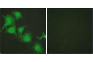 Immunofluorescence analysis of HuvEc cells, using Nrf2 Antibody. (NRF2 Antikörper  (AA 556-605))