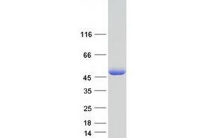 Western Blotting (WB) image for Homer Homolog 3 (Drosophila) (HOMER3) (Transcript Variant 1) protein (Myc-DYKDDDDK Tag) (ABIN2722959)