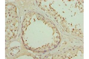 Immunohistochemistry of paraffin-embedded human testis tissue using ABIN7150657 at dilution of 1:100 (DSCR9 Antikörper  (AA 1-149))