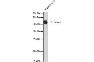 Western blot analysis of extracts of Mouse lung, using β-Catenin antibody (ABIN1684202, ABIN1512789, ABIN3020926 and ABIN3020928) at 1:1000 dilution. (CTNNB1 Antikörper)