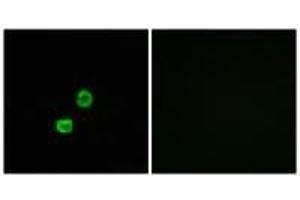 Immunofluorescence analysis of MCF-7 cells, using GCNT7 antibody. (GCNT7 Antikörper)