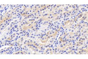 Immunohistochemistry (IHC) image for anti-Leptin (LEP) (AA 22-167) antibody (ABIN7445093)