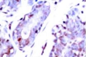 Image no. 2 for anti-Signal Transducer and Activator of Transcription 1, 91kDa (STAT1) (pTyr701) antibody (ABIN318124)