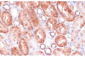 Immunohistochemistry of paraffin-embedded Rat kidney using VASP Polyclonal Antibody at dilution of 1:100 (40x lens). (VASP Antikörper)