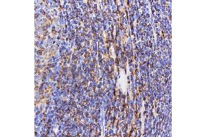 IHC analysis of SEPT6/SEPTIN6 using anti-SEPT6/SEPTIN6 antibody (ABIN7599390).