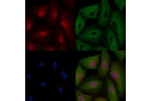 ABIN6264433 and ABIN6276469 staining  cells by IF/ICC. (PRMT1 Antikörper  (C-Term))