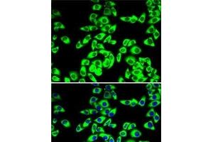 Immunofluorescence analysis of MCF7 cells using RPL14 Polyclonal Antibody (RPL14 Antikörper)
