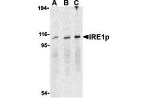 Western Blotting (WB) image for anti-Endoplasmic Reticulum To Nucleus Signaling 1 (ERN1) (C-Term) antibody (ABIN1030448) (ERN1 Antikörper  (C-Term))