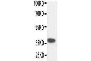 Anti-Kallikrein 5 antibody, Western blotting WB: Mouse Liver Tissue Lysate (Kallikrein 5 Antikörper  (C-Term))