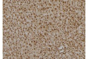 Immunohistochemistry (IHC) image for anti-Proteasome (Prosome, Macropain) 26S Subunit, ATPase, 6 (PSMC6) (Internal Region) antibody (ABIN6264483)
